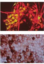 Neurons generated from monkey's embryonic stem cells